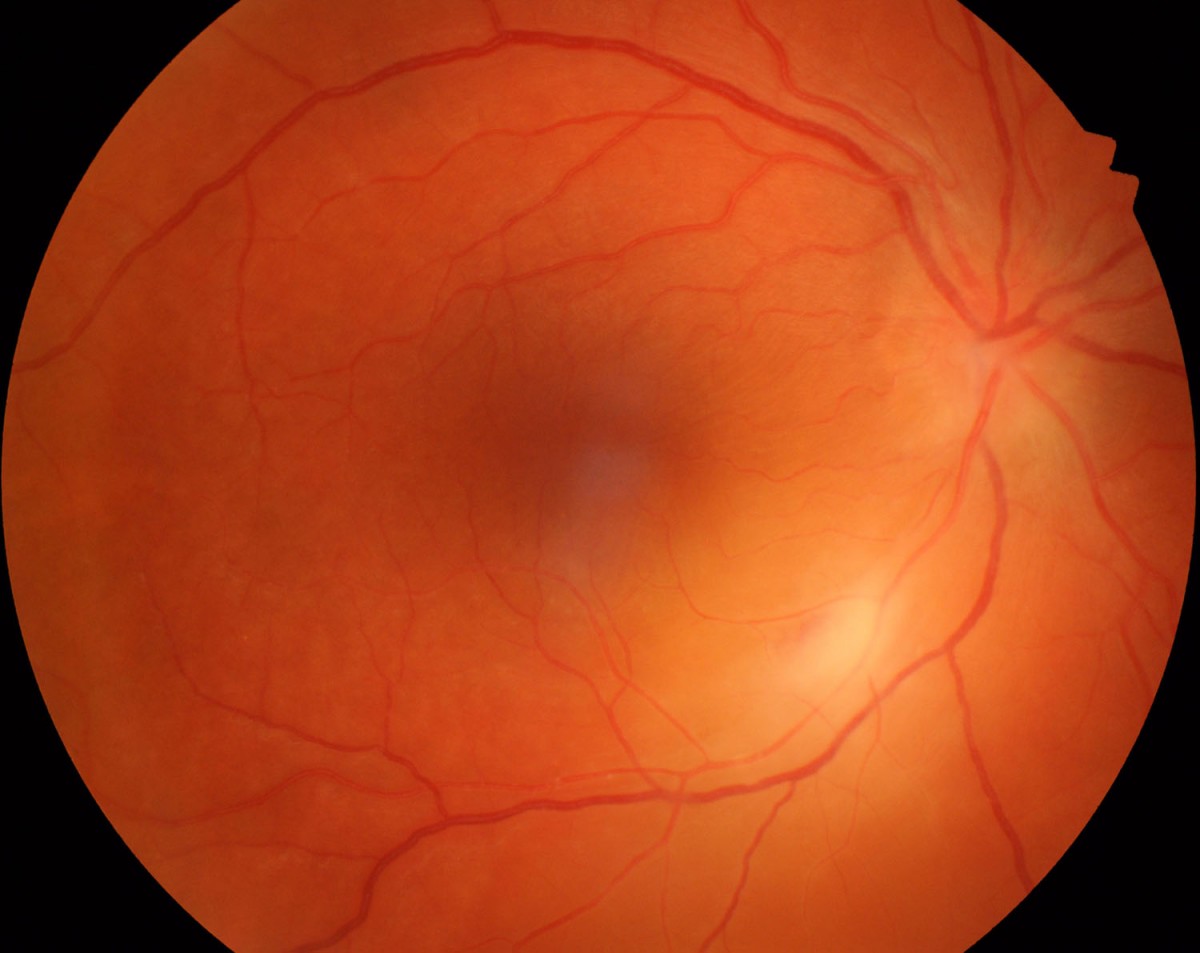 retina eye associates